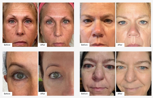 Images of actual customers' Before & After photos displaying their Real Results with SIG-1723.